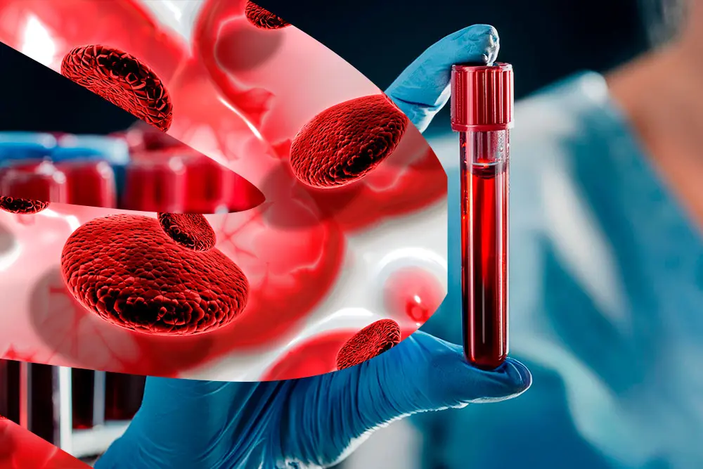 Hablemos de… El nuevo “manual de la RHOVE, 2024” y su concordancia con CDC, NHSN. Parte 3 de 4